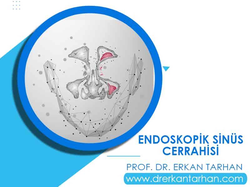 endoskopik-sinus-cerrahisi-fesc-nasil-yapilir-herkes-icin-uygun-mudur-prof-dr-erkan-tarhan