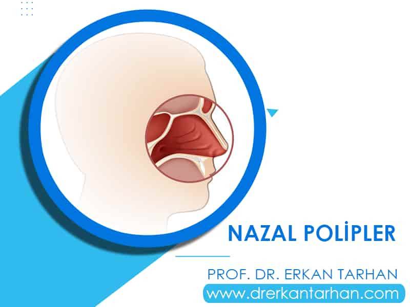 nazal-polipler-prof-dr-erkan-tarhan