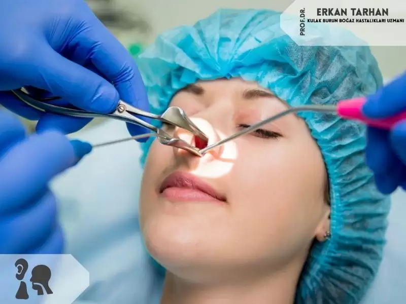 endoskopik-sinus-cerrahisi-fess