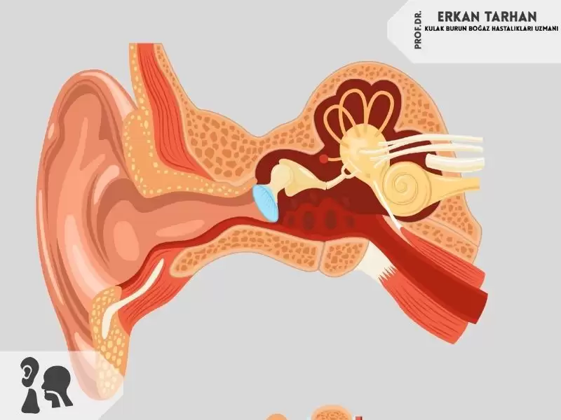 Kulak Zarı Deliklerinin Tedavisi Nasıl Yapılır?