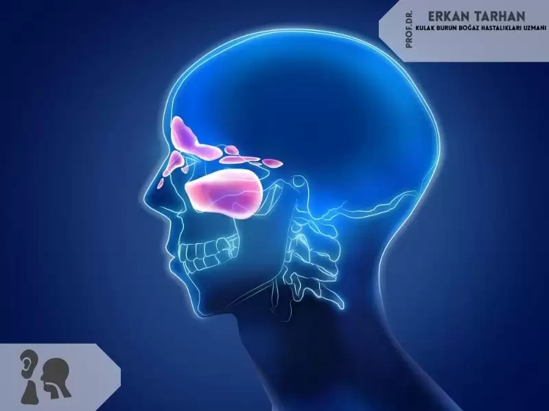 Sinüs ve Sinüzit Nedir?